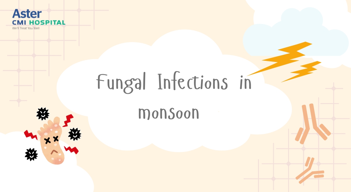 Fungal Infections in monsoon 