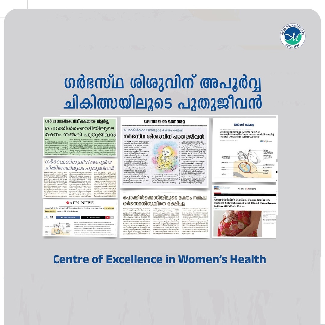 ഗർഭസ്ഥശിശുവിന് കടുത്ത വിളർച്ച: പൊക്കിൾക്കൊടിയിലൂടെ രക്തം നൽകി രക്ഷിച്ച് ആസ്റ്റർ മെഡ്സിറ്റി