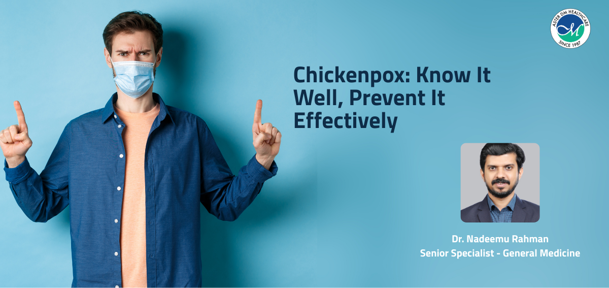 Chickenpox: Know It Well, Prevent It Effectively