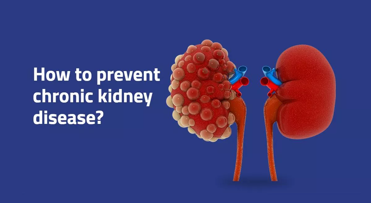 How To Prevent Chronic Kidney Disease | Aster RV Blogs