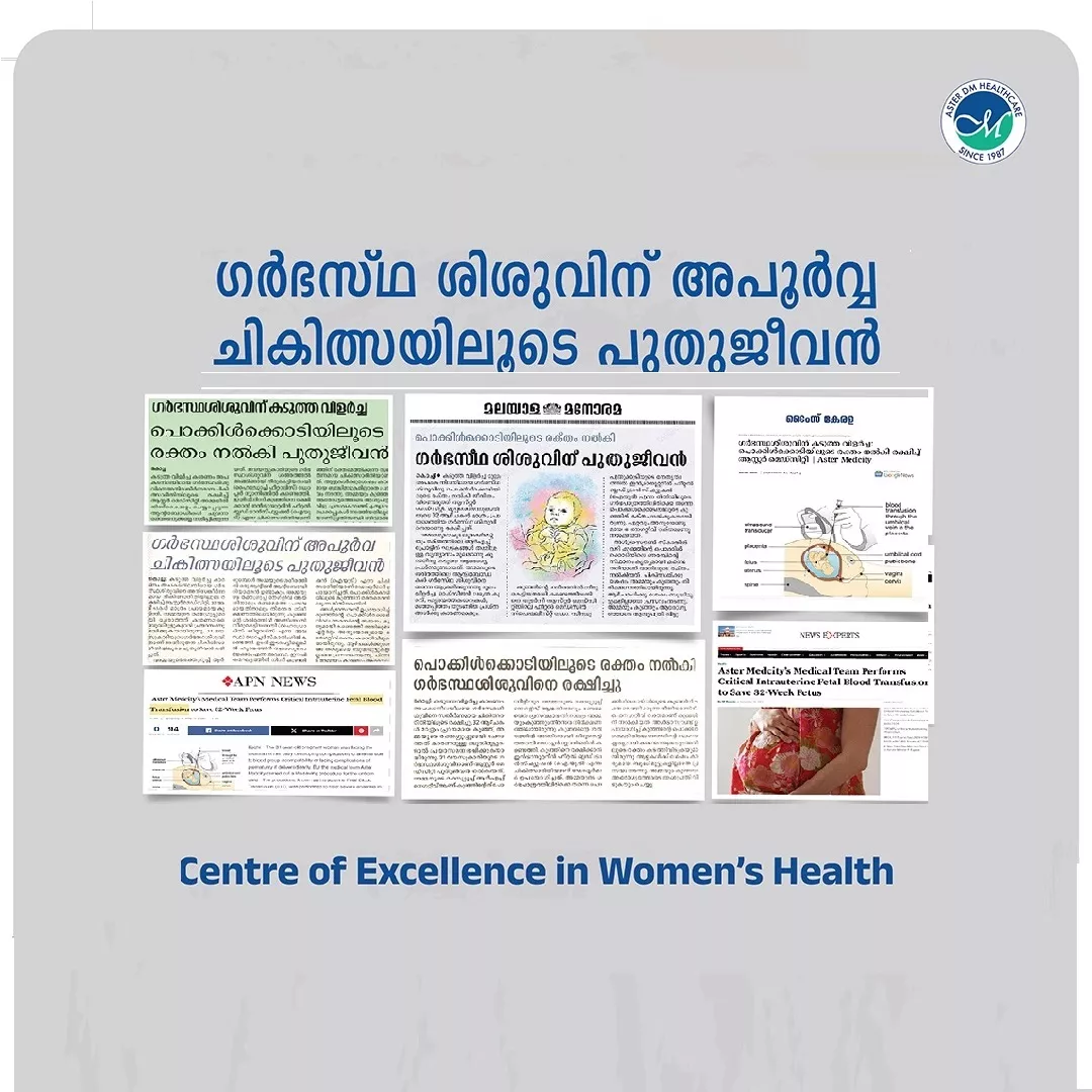 ഗർഭസ്ഥശിശുവിന് കടുത്ത വിളർച്ച: പൊക്കിൾക്കൊടിയിലൂടെ രക്തം നൽകി രക്ഷിച്ച് ആസ്റ്റർ മെഡ്സിറ്റി