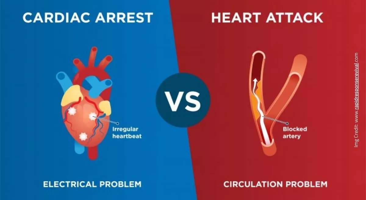 Heart Attack vs. Cardiac Arrest