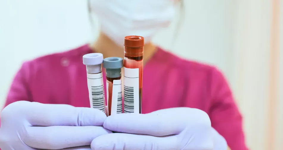 blood platelet count