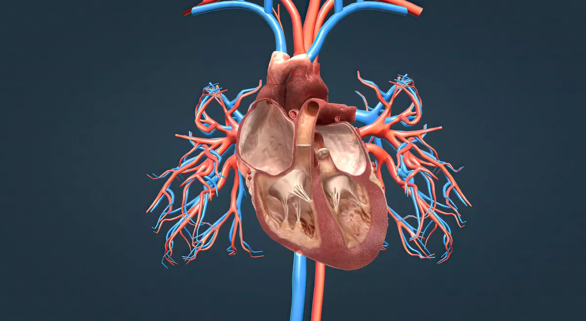 Acute Iliofemoral DVT and Pulmonary Embolism