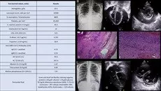 Inflammatory Syndrome Dr wasagaonkar.jpg