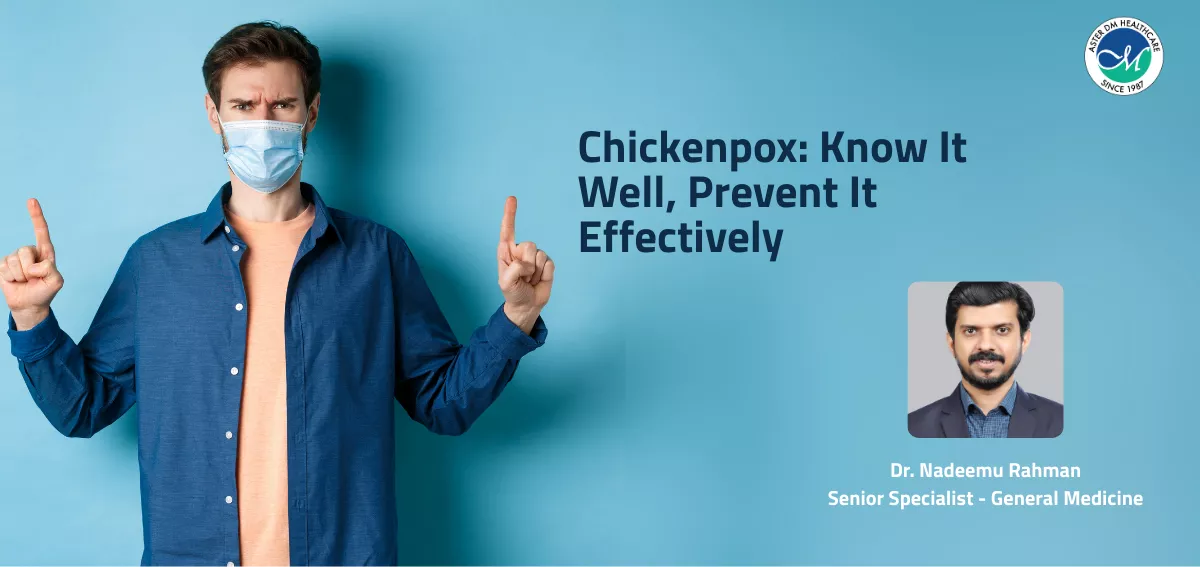 Chickenpox: Know It Well, Prevent It Effectively