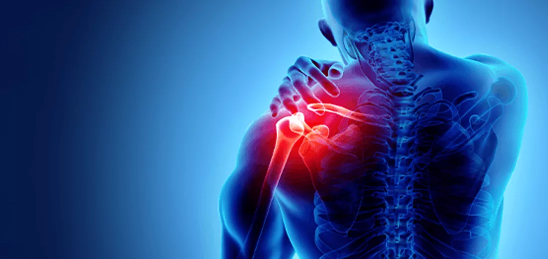Understanding the Causes of Shoulder Pain and How to Get Relief